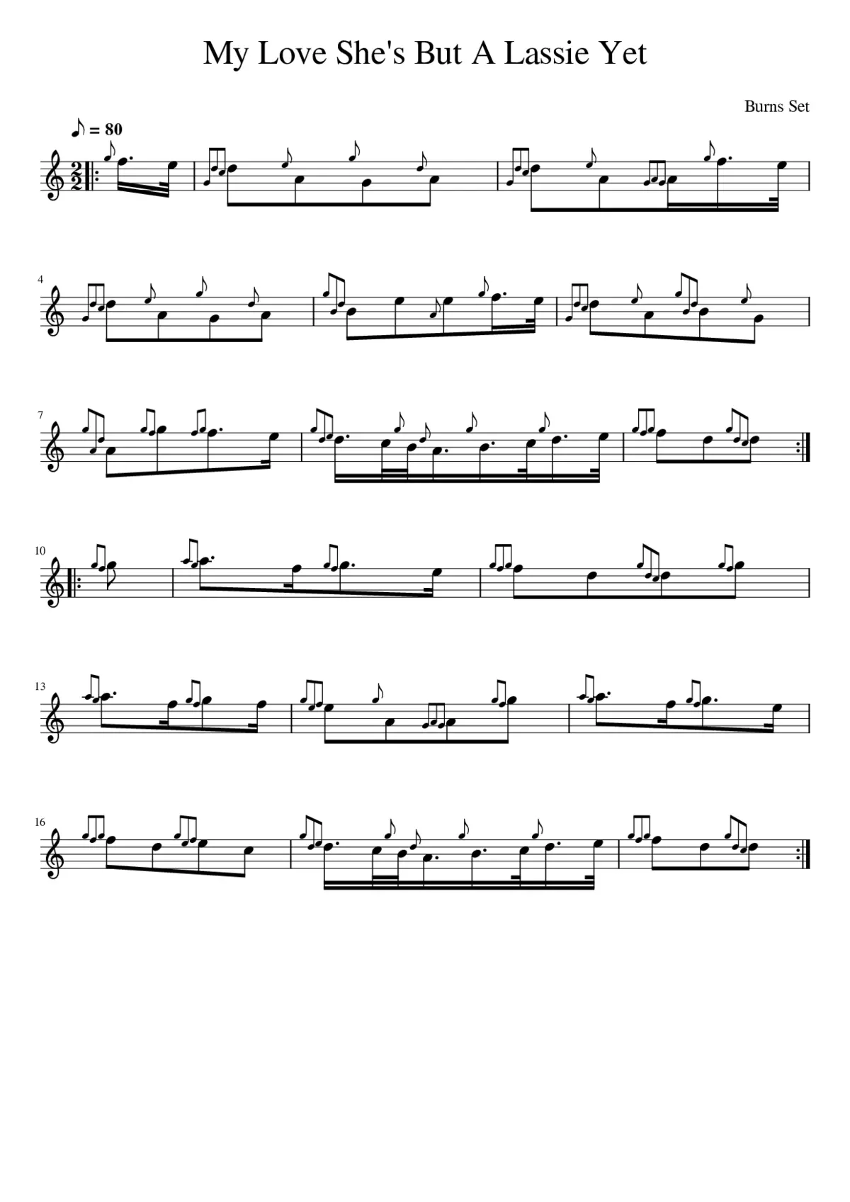 My Love She's But A Lassie Yet - Page 1