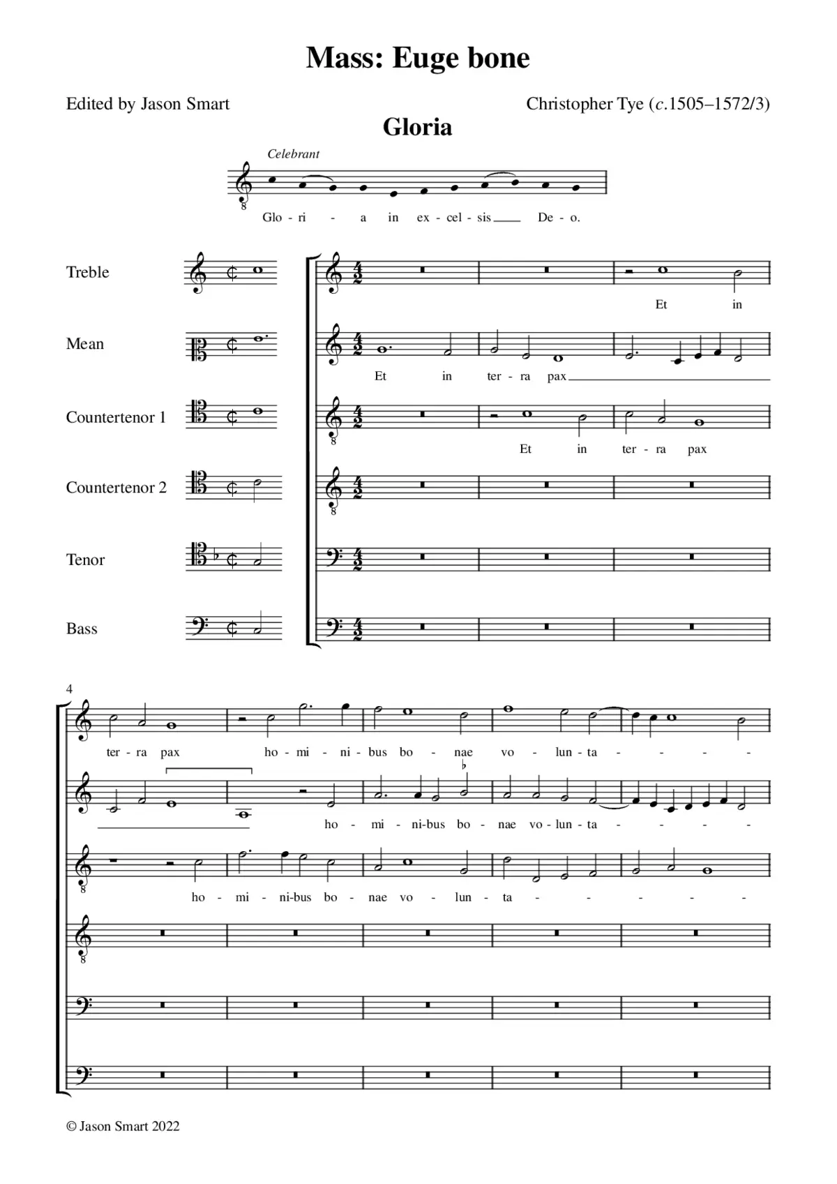 Mass Euge bone - Page 1