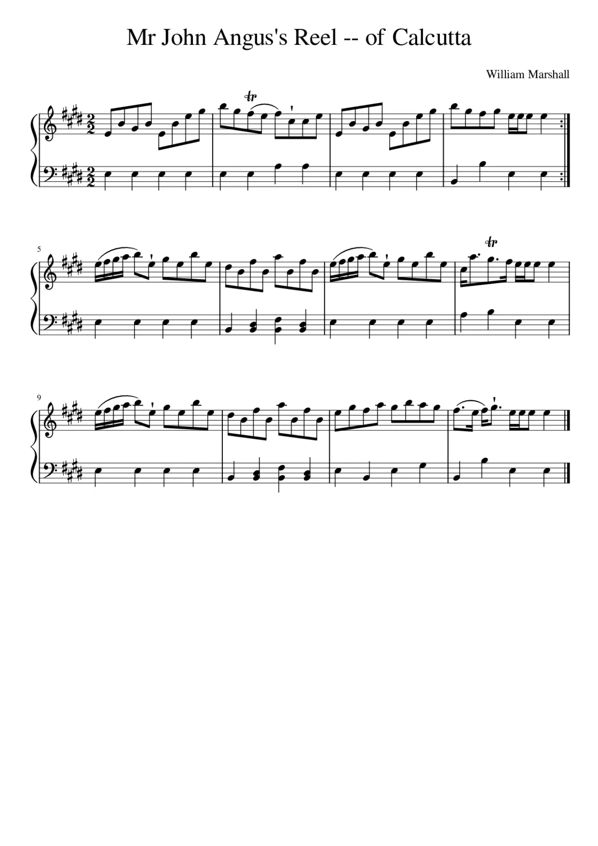 Mr John Angus's Reel -- of Calcutta - Page 1