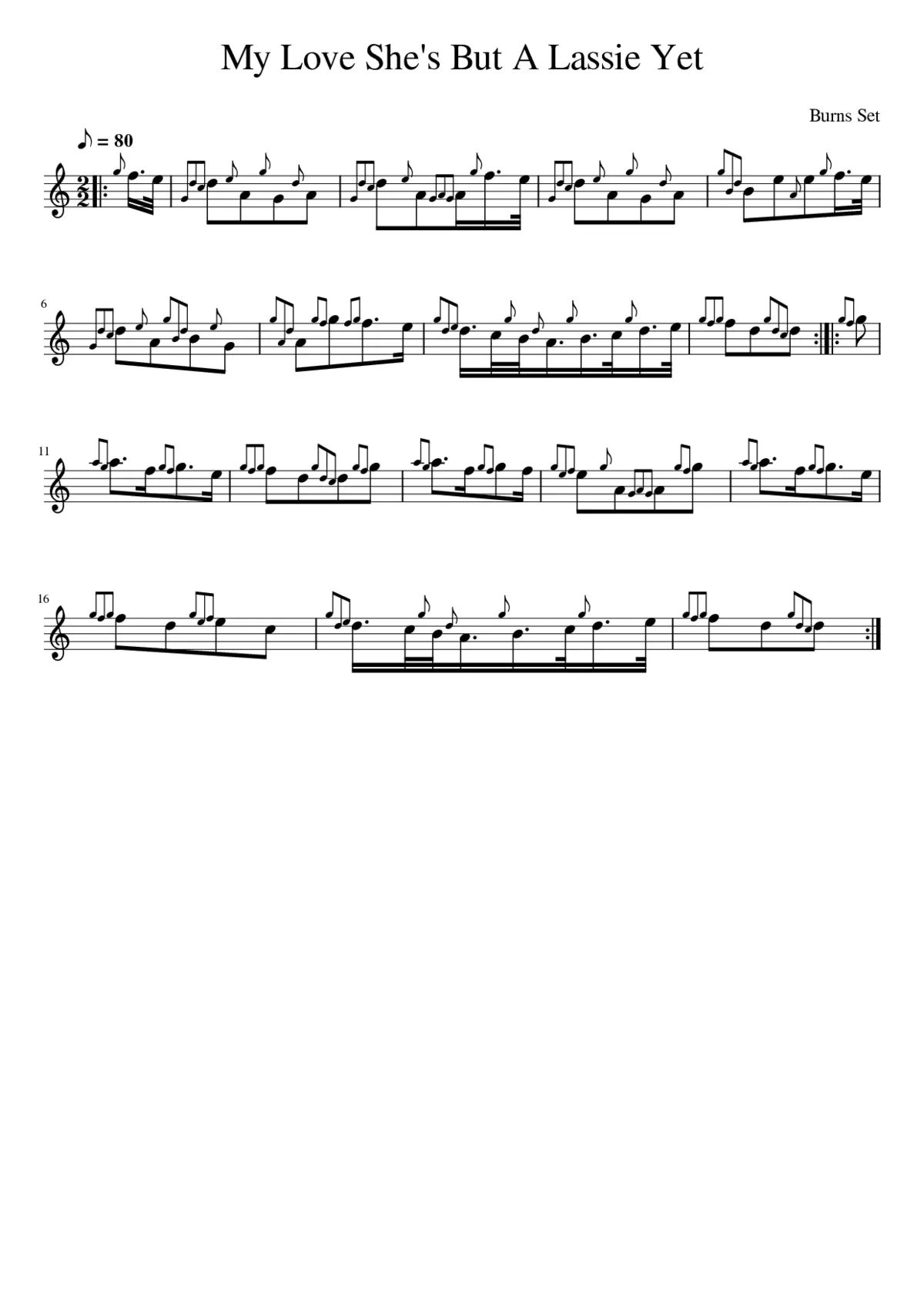 My Love She's But A Lassie Yet - Page 1