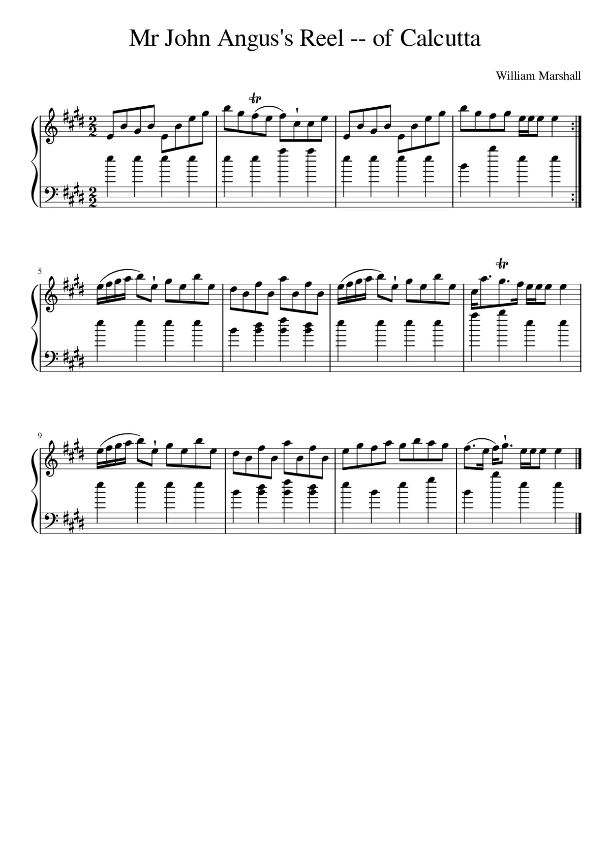 Mr John Angus's Reel -- of Calcutta - Page 1